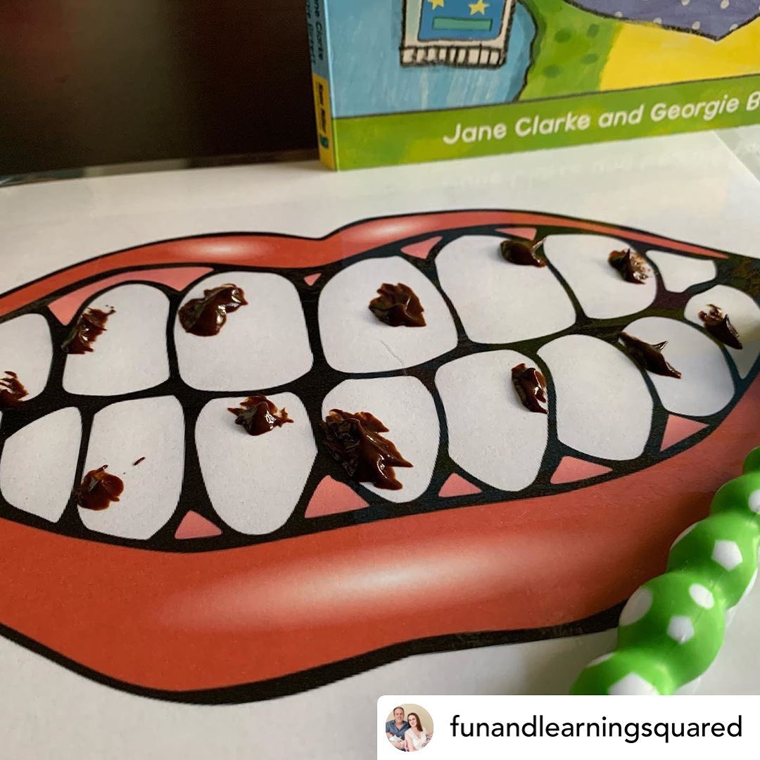 Remove Those Cavities!